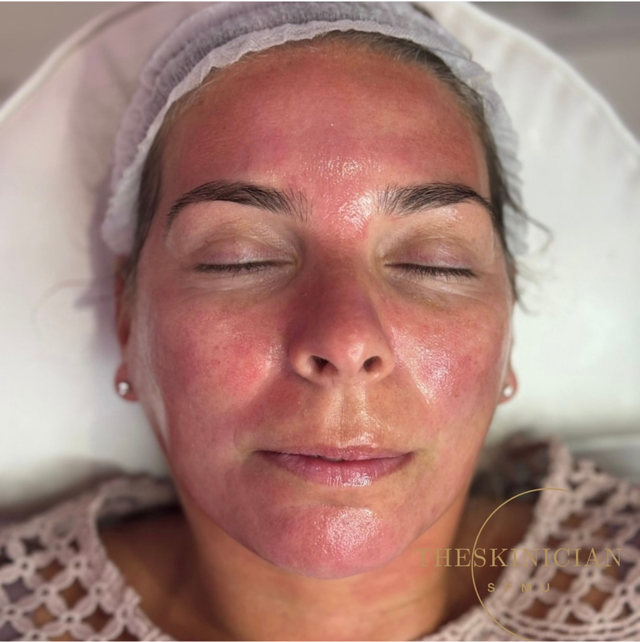 Facials in Preston – Feel Comfortable in Your Own Skin at The Skinician