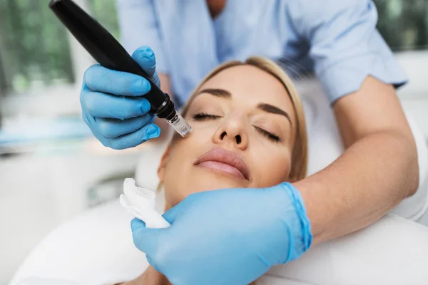 Microneedling Preston