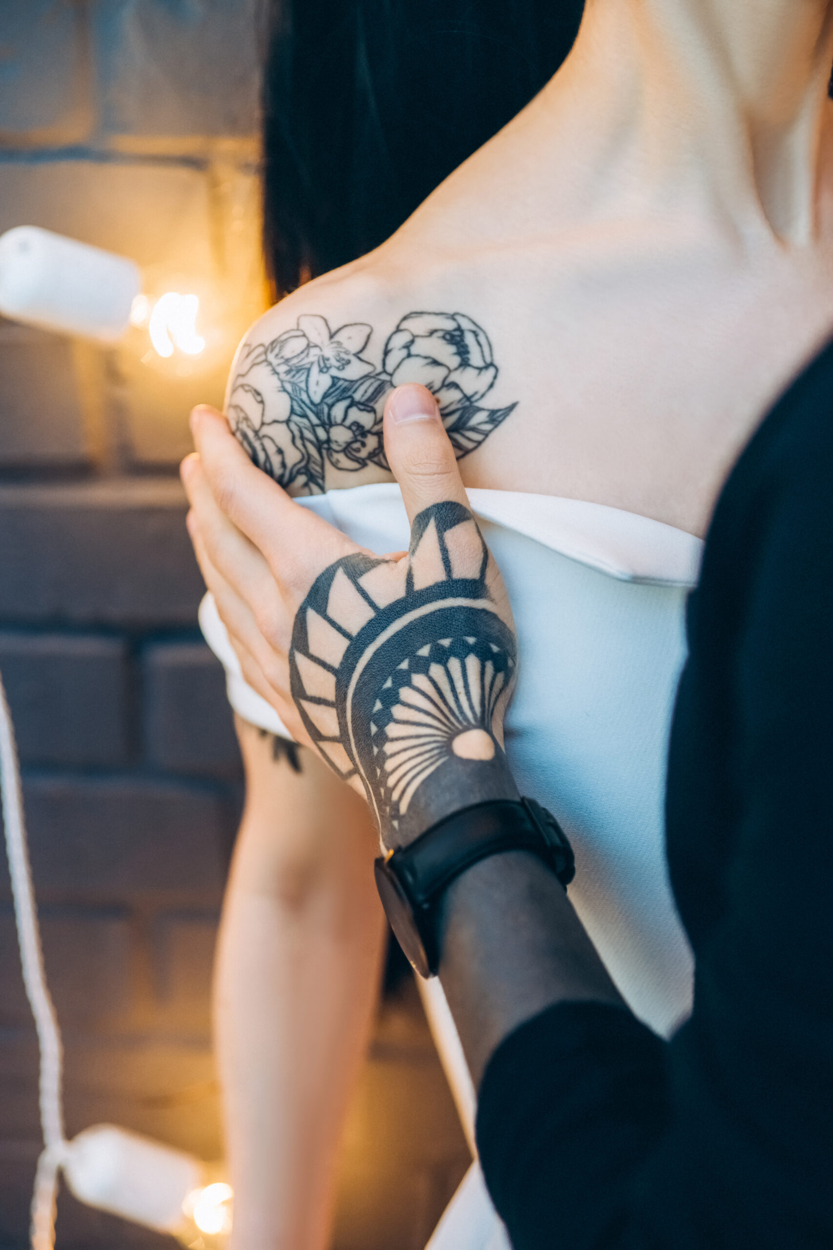 Laser tattoo removal in Preston