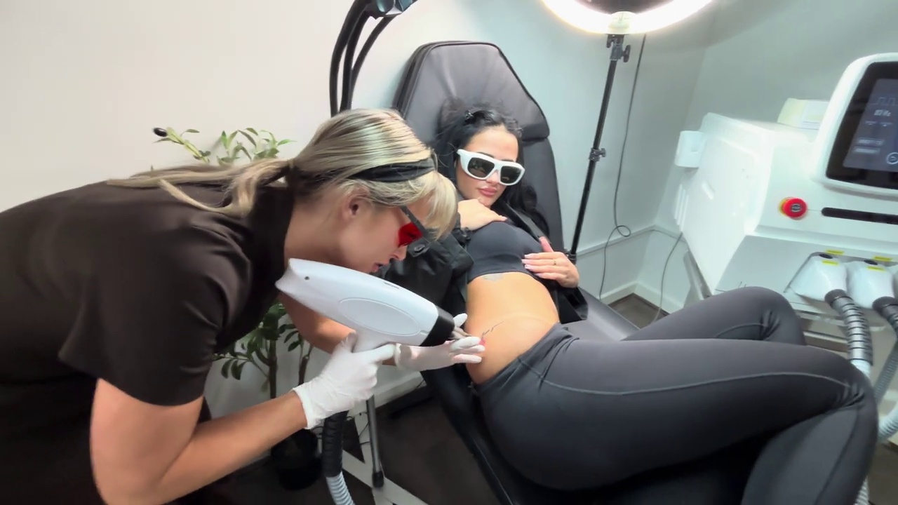 Tattoo Removal Still Image